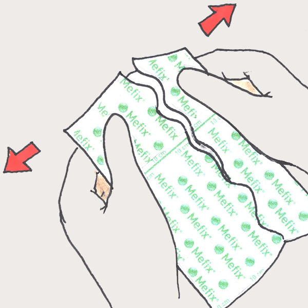 Mölnlycke Mefix Self-adhesive fabric Hypoallergenic Dressing Tape - Anjelstore