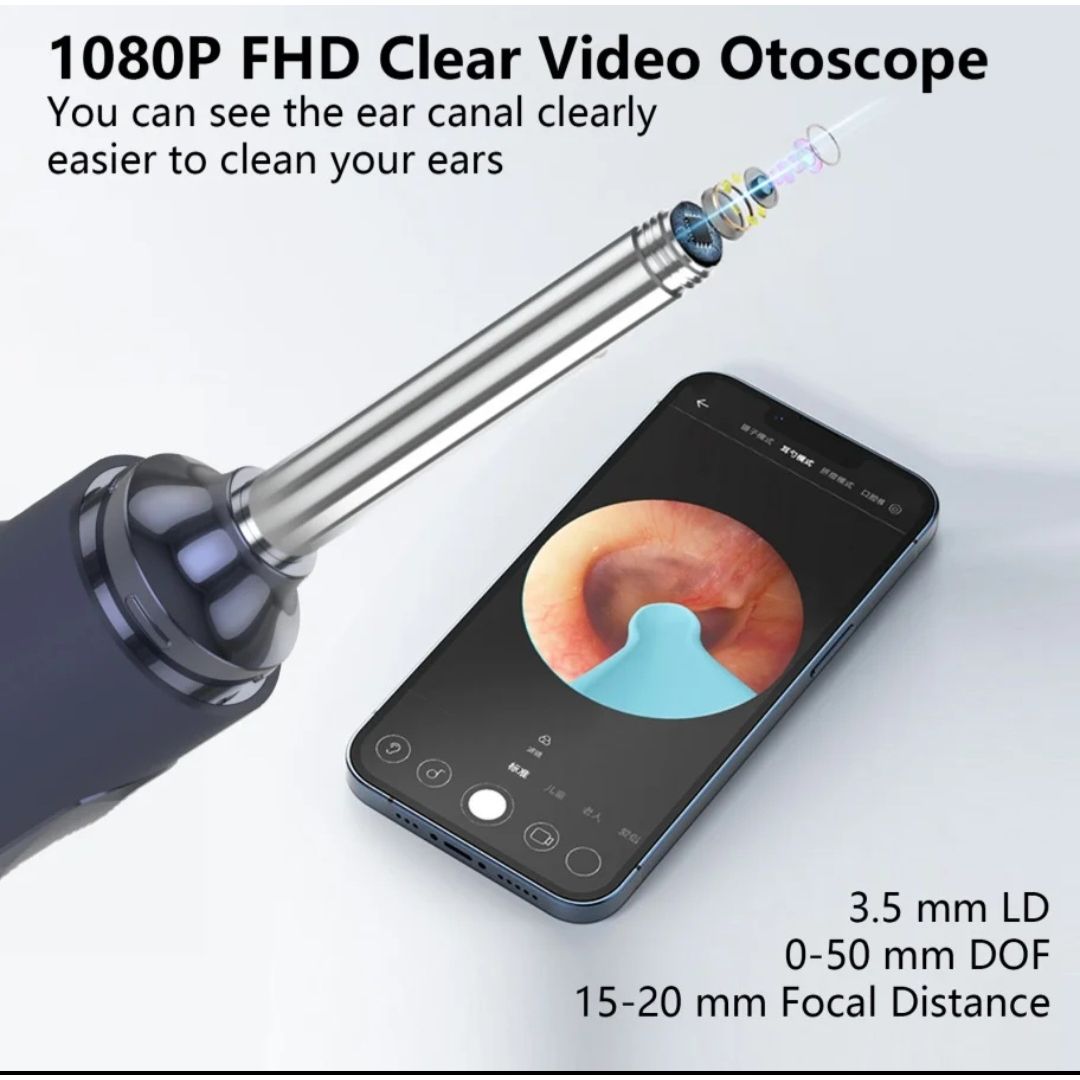 Smart WiFi Visual Ear Cleaner with HD Camera | Wireless Ear Wax Removal