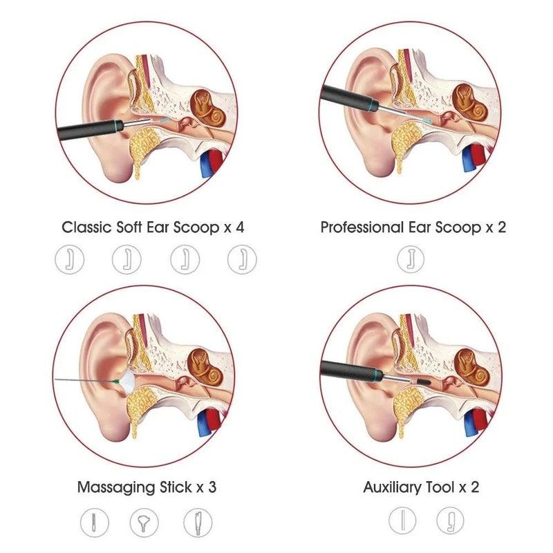 Bebird Smart Visual Ear Cleaner - Anjelstore 