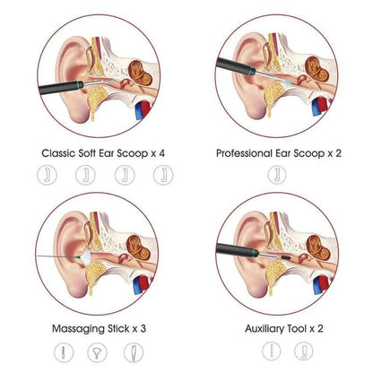 Bebird Smart Visual Ear Cleaner - Anjelstore 
