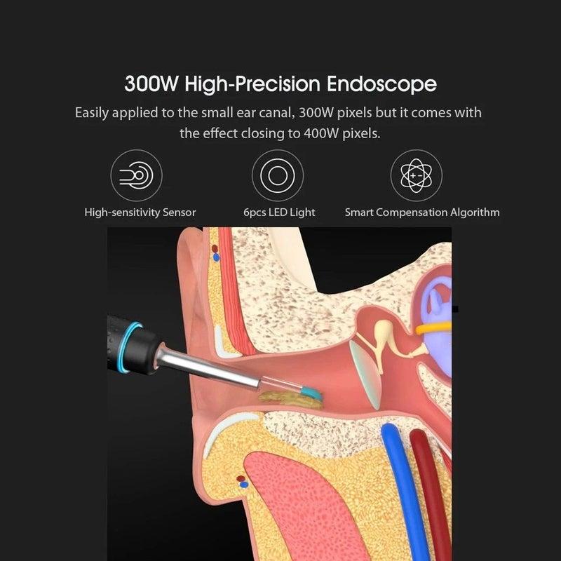Bebird Smart Visual Ear Cleaner - Anjelstore 