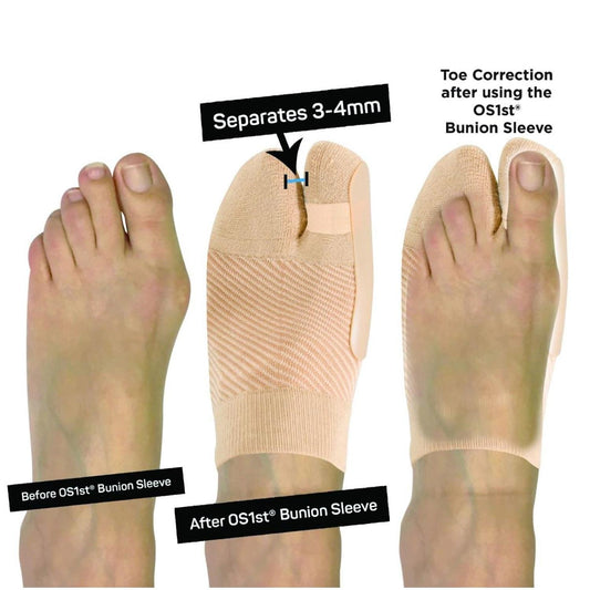 OS1 HV Bunion bracing foot mild compression sleeve. - Anjelstore 